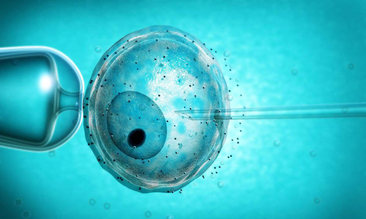 试管婴儿性别筛选的伦理探讨与技术分析